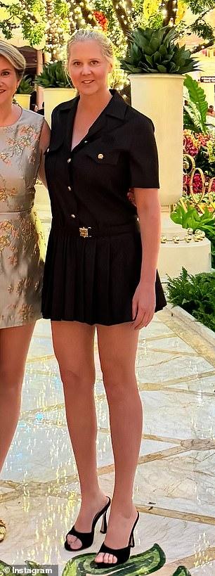 News Room : Slim Amy Schumer's LEGS drive fans wild