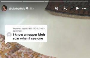 News Room : Abbie Chatfield denies she has had plastic surgery – as a follower accuses her of having her eyelids ‘cut off’