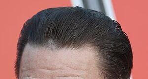 News Room : Hollywood embraces hair transplants: All the stars who have admitted to going under the knife as John Cena reveals the treatment ‘changed his life’