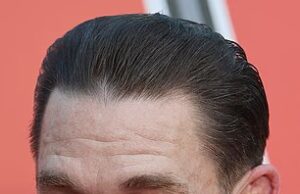 News Room : Hollywood embraces hair transplants: All the stars who have admitted to going under the knife as John Cena reveals the treatment ‘changed his life’